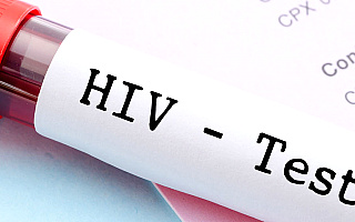 Druga osoba w historii całkowicie wyleczona z zakażenia HIV. „Jesteśmy przekonani, że ten wirus jest uleczalny”